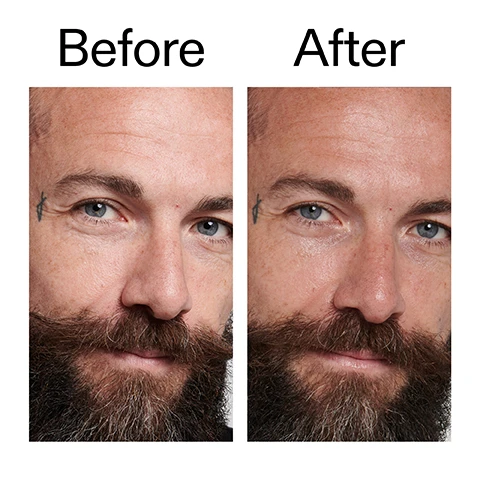Image 1 - A mans face in a before and after comparison, showing his beard changing from reddish-brown to a darker brown, with the visible text Before After. Image 2 - A close-up of a womans face looking up with hands gently touching her cheeks, alongside the text Why we love it, Lightweight hydration, Firms and plumps skin, and Reduces the appearance of fine lines and wrinkles. Image 3 - A white creamy product smudge on a white background, with text that reads: Why it works, 2% Royal Epigen P5™, EVENS SKIN TONE AND DELAYS THE AGING OF SKIN CELLS., 1% Hydrating Peptide Solution, SUPPORTS MOISTURE BARRIER FOR VISIBLY RADIANT SKIN. Image 4 - A hand holds a white tube of THE INKEY LIST™ PEPTIDE MOISTURIZER, 1.7 US fl. oz / 50ml e, which states Helps reduce the visible signs of aging and Aide à réduire les signes de l’âge, next to instructions How to use: USE AM + PM. PEA-SIZED AMOUNT. MASSAGE INTO FACE AND NECK. AFTER CLEANSER AND SERUM, BEFORE SPF IN THE AM. Image 5 - A white, creamy background displays text that reads: How to layer your routine, followed by a numbered list 1 CLEANSE, 2 HYDRATE, 3 TREAT, 4 MOISTURISE, 5 SPF.
