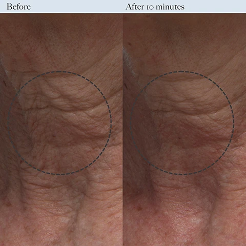 Image 1 - Side-by-side comparison of a persons neck skin showing wrinkles and lines labeled Before on the left and smoother skin labeled After 10 minutes on the right, with both images enclosed in dashed circles.
Image 2 - Image shows two side-by-side comparisons of a skin area with the left labeled Before and the right labeled After 10 minutes, highlighting a visible improvement in skin texture.
Image 3 - Image shows three clear blocks with key skincare ingredients: a block contains a creamy substance labeled Bio-Fermented Polish with a description about exfoliating dead skin cells, another block showcases pomegranate seeds labeled Pomegranate Enzyme with its exfoliating properties, and the last block is labeled Niacinamide with a description highlighting its benefits for skin hydration and barrier fortification.