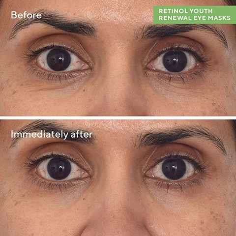 image 1, before and immediately after. image 2, retinol youth renewal eye masks. retinol tri active technology - visibly minimises lines while being gentle on skin. blue algae extract - visibly firms and reduces appearance of wrinkles in minutes. unique, extra large shape - designed by skinfluencer superstar dr. zion ko to address concerns on the face and eyes. no slip bio cellulose mask - derived from hydrating coconut water, boosts ingredient delivery and efficacy. improve firmness around eyes - 93% agree that firmness around the eyes is improved. clinically proven results based on expert grading, conducted on 30 participants, aged 35-65 after one 15 minute application. image 3, 93% agreed that firmness around the eye area is visibly improved. 80% showed immediate measured improvement in crow's feet lines and wrinkles. 70% showed immediate measured reduction of under eye puffiness. clinically proven results based on expert grading, conducted on 30 participants, aged 35-65 after one 15 minute application. based on a clinical study of 30 participants aged 35-65 after one 15 minute application. image 4, evening routine for brighter morning eyes. results you'll see for yourself. 1 = after cleansing, apply retinol youth renewal eye masks for 15 minutes, remove and pat in any remaining product. 2 = retinol youth renewal eye serum - follow with a think later of retinol eye serum around the under eyes and lids.