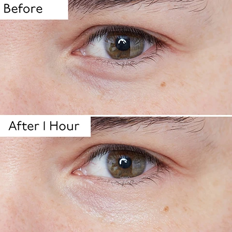 Image 1 - Close-up comparison of a persons eye, showing a reduction in under-eye circles from the top image to the bottom, labeled Before and After 1 Hour. Image 2 - A before and after comparison shows a persons eye area with dark undereye circles and wrinkles above, and the same eye area with noticeably reduced dark circles and smoother skin below, labeled Before and After 1 Hour. Image 3 - A close-up image shows a white cosmetic tube with a silver cooling applicator and a dark purple cap, with visible text reading Cooling Applicator, INSTANTLY BRIGHTENS AND DE-PUFFS, and HYALU GLOBAL 8 HYALUR EXCLUSIVE. Image 4 - A product image displaying a By Terry Hyaluronic Global Eye Serum tube with a rollerball applicator, a dollop of cream, coffee beans, and scientific glassware, with text listing its benefits and ingredients: Key Ingredients HYDRATES & PLUMPS 3% Hyaluronic Acid NOURISHES & PROTECTS 10% Phytosqualane BRIGHTENS & EVENS TONE 5% Niacinamide REDUCES PUFFINESS & DARK CIRCLES 3% Caffeine BY TERRY HYALURONIC GLOBAL EYE SERUM 8 HYALURONIC ACIDS EXCLUSIVE TECHNOLOGY VEGAN FORMULA CLEAN FORMULA. Image 5 - A white eye cream tube with a silver applicator dispenses cream onto a lavender surface, with text highlighting product benefits: DE-PUFFS with cooling applicator, IMPROVES firmness & elasticity, REDUCES dark circles, MOISTURIZES & PLUMPS, IMPROVES elasticity, SMOOTHS lines & wrinkles, and text on the tube reads HYALURONIC GLOBAL 8 HYA EXCLUSIVE. Image 6 - A close-up of a persons eye area shows small white dots of product applied, with a hand holding a white and purple By Terry Hyaluronic Global Eye Serum tube featuring a silver rollerball applicator, next to text that reads 101% increase in hydration.** 96% agree skin feels nourished.*** 90% saw reduced under-eye bags.*** BY TERRY HYALURONIC GLOBAL EYE SERUM 8 HYALURONIC ACIDS EXCLUSIVE TECHNOLOGY *After 3 weeks. **One hour after application - Clinical evaluation on 11 people. ***Satisfaction test on 23 volunteers. Image 7 - The image shows four By Terry Hyaluronic skincare products, including a purple and white tube, a white dropper bottle, a purple and white jar, and a tall purple spray bottle, with text reading Hyaluronic Skincare Ritual, STEP 1: Hyaluronic Global Serum, STEP 2: Hyaluronic Global Face Cream, STEP 3: Hyaluronic Global Eye Serum, STEP 4: Hyaluronic Glow Setting Mist, and detailed product labels By Terry Hyaluronic Global Eye Serum 8x Hyaluronic Acid Types Exclusive Technology, By Terry Hyaluronic Global Serum 8x Hyaluronic Acid Types Exclusive Technology, By Terry Hyaluronic Global Face Cream 8x Hyaluronic Acid Types Exclusive Technology, and By Terry Hyaluronic Glow Setting Mist 8x Hyaluronic Acid Types Exclusive Technology Prime - Fix - Glow Ultra Care Spray Up To 16 Hours Spray Ultra Soin Préparateur Éclat Fixateur Maquillage. Image 8 - The image shows a By Terry Hyaluronic Global Eye Serum tube next to its refill, demonstrating how to transfer the Zamac applicator and cap from the original tube to the refill tube, featuring text like HYALURONIC GLOBAL EYE SERUM, TERRY, 8 HYALURONIC ACIDS, EXCLUSIVE TECHNOLOGY, REFILL HYALURONIC GLOBAL EYE SERUM, and Reuse the ZAMAC applicator and cap on the REFILL tube.