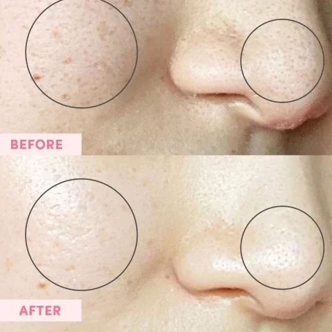 before and after model shot