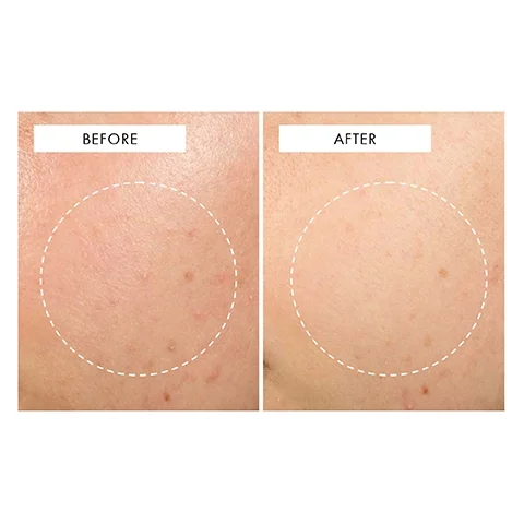 before and after