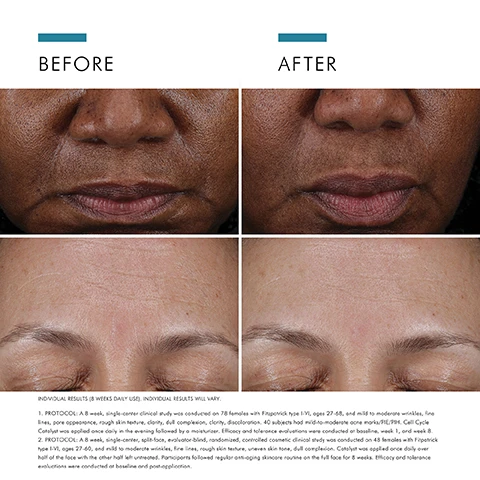 Image 1 - Before and after images showing close-up views of womens faces, with noticeable improvements in skin texture and appearance after treatment; visible text includes BEFORE and AFTER at the top, along with detailed text below describing the studys protocol and results.
Image 2 - An image of a clear serum dropper with droplets of serum in a petri dish, accompanied by text describing key ingredients: 7.7% MULTI-ACIDS - Multi-layer action to gently peel and enhance skin renewal cycles for smoother texture, reduced visible discolouration and improved appearance of fine lines; 1% TAURINE - A high concentration of an amino acid (naturally found in skin).
Image 3 - A close-up of a woman with brown skin and dark hair applying a dropper of serum to her cheek, with visible text that reads accelerates cell turnover and boosts anti-ageing routine results.
Image 4 - The image shows a white background with various glossy, clear serum drops and circles, accompanied by text that reads: AT A GLANCE, TEXTURE, Lightweight serum texture, SKIN TYPE, Ageing, Normal, Combination, Dry, Oily.
Image 5 - Black and white image of a woman with long dark hair wearing a blazer, smiling slightly, accompanied by a quote about a skincare product attributed to Dr. Ana Mansouri, Aesthetic Doctor at Dr Ana The Skin Clinic in Birmingham.
Image 6 - A close-up image of a woman applying a serum to her face, with step-by-step instructions on the left side reading: HOW TO APPLY, STEP 1: Once daily after cleansing, apply 1/3 of a dropper amount with a cotton pad or clean hands to a dry face, STEP 2: Use before a SkinCeuticals antioxidant and moisturiser. In the morning, follow with a broad-spectrum sunscreen.
Image 7 - Image shows a skincare routine with four labeled steps, each featuring a product: Step 1 is CELL CYCLE CATALYST, Step 2 is C E FERULIC®, Step 3 is A.G.E. INTERRUPTER ADVANCED, and Step 4 is ADVANCED BRIGHTENING UV DEFENSE SUNSCREEN SPF 50.