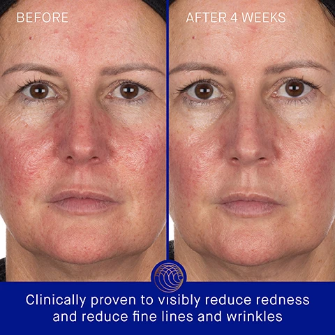 Image 3 - Image showing a womans face with a comparison between the left side labeled BEFORE and the right side labeled AFTER 4 WEEKS, indicating a noticeable reduction in redness and fine lines, with the text Clinically proven to visibly reduce redness and reduce fine lines and wrinkles at the bottom.
Image 4 - An orange facial mask is displayed on a light surface with text that states clinically proven results: skin hydration improved by 95%, skin luminosity improved by 42%, crows feet fine lines reduced by 17%, along with additional details about a clinical trial.
Image 5 - A close-up of a womans face with glowing, golden skincare applied, displaying user results: 90% agree skin texture looks and feels smoother, 92% agree skin feels instantly hydrated, and 78% agree skin appears firmed and lifted, followed by fine print about a consumer perception study.
Image 6 - An orange facial mask with cutouts for the eyes and mouth is centered on a blue background, surrounded by four text boxes that explain ingredients: TFC8® - A proprietary technology that creates the optimal environment for skin cellular renewal, Acetylated Hyaluronic Acid - Deeply hydrates and plumps, Copper Peptide - Helps support natural collagen production, firming and plumping skin, and Fermented Polysaccharide - Illuminates and helps reduce appearance of fine lines and wrinkles.
Image 7 - Two images are presented; the top image shows a person applying a golden facial mask, while the bottom image features the same individual gently removing the mask. The text includes Step 1: Apply the mask to your face, starting with the top half and then the bottom. Leave on for 20 minutes, followed by Step 2: Remove and pat in excess serum before following with your Augustinus Bader skincare routine and AB Insider Tip: Use at least 2-3 times per week. Put in the fridge before use for extra cooling and de-puffing benefit.