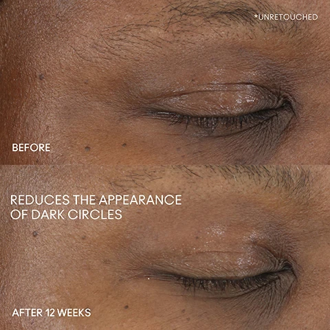 Image 1 - Before and after images showing the reduction of dark circles under the eyes, with the top image labeled as BEFORE and the bottom image stating REDUCES THE APPEARANCE OF DARK CIRCLES and AFTER 12 WEEKS.
Image 2 - Four close-up images of diverse individuals eyes demonstrate various areas to apply a skincare product, labeled as under eyes, outer corners, inner corners, and all over lids, with a product bottle of MAC Hyper Real Serumizer Eye in the bottom right corner.
Image 3 - Image features two cosmetic products: a small golden bottle labeled MAC Hyper Real Serumizer Eye and a black tube labeled Studio Radiance with visible text stating Instantly: Conceals Hydrates Brightens and After 12 weeks: Visible reduction in 360º dark circles along with a circular badge indicating 80% skincare ingredients.