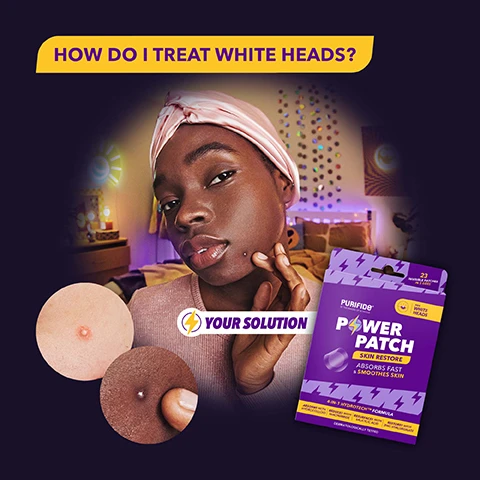 Image 1 - A young person with dark skin and pink headscarf poses thoughtfully, with an image of two skin blemishes on the left and a pack of Purifide Power Patch labeled Your Solution on the right, accompanied by text asking, How do I treat white heads? and stating Absorbs fast & smoothes skin.
Image 2 - An infographic displaying a circular diagram labeled 4-IN-1 HYDROTECH™ FORMULA, showcasing the ingredients Hydrocolloid, Salicylic Acid, Niacinamide, and Zinc Hyaluronate, with text that reads FROM THE MAKERS OF ACNECIDE THE #1 SPOT TREATMENT BRAND and CLINICALLY PROVEN FORMULA.
Image 3 - A group of three young people poses in a colorful setting, with text overlay featuring SKIN RESTORE for WHITE HEADS, along with the words ABSORBS, REDUCES, RESURFACES, and RESTORES.
Image 4 - Image comparing Purifide Skin Restore to a generic hydrocolloid patch, highlighting features such as absorbs impurities, resurfaces skin & prevents blemish marks, 4-in-1 Hydrotech™ formula, and developed with dermatologists, with checkmarks for Purifide and crosses for the other.
Image 5 - Image showing a product labeled PURIFID® Daily Cleanser with four steps outlined for use: STEP 1 - CLEANSE: Try our Daily Cleanser; STEP 2 - APPLY: To clean dry skin; STEP 3 - WEAR: Sweat proof & make-up friendly; STEP 4 - REMOVE: Once white or after 8 hours wear, accompanied by images of diverse individuals applying and smiling while demonstrating the steps.
Image 6 - An image comparing two types of Power Patch products for skincare, labeled for For Emerging Spots and For White Heads, with descriptions indicating uses for each type, including RED + IRRITATING OR PAINFUL and RAISED WITH A WHITE-HEADED TIP, alongside the packaging designs of Power Patch Fast Fix and Power Patch Skin Restore.