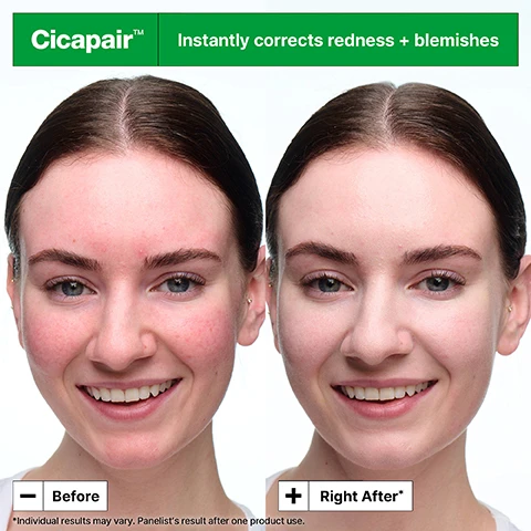 Image 2 - Before and after image of a womans face showing reduced redness and blemishes with text Cicapair™ Instantly corrects redness + blemishes Before Right After* *Individual results may vary. Panellists result after one product use. Image 3 - Text reads Upgraded formula that instantly neutralises redness, +Barrier care, +Mineral sunscreen SPF 30, +Easy to blend texture, shown next to a jar of Dr.Jart+ Cicapair Soothing Color Correcting Treatment with label text Cica Complex, Broad Spectrum SPF 30, 55 mL / 1.85 fl. oz. Image 4 - Woman holding a jar of Dr. Jart+ Cicapair cream near her face and smiling, with text overlay reading 96% agreed it instantly corrects visible redness* Dr. Jart+ Cicapair Soothing Color Correcting Treatment Cica Complex Broad Spectrum SPF 30 55 mL / 1.85 fl. oz. *Consumer testing on 109 women after using product once. Image 5 - Two jars of Dr Jart+ Cicapair cream on a green background with green cross shapes are shown next to text that reads Centella Asiatica Extracts Reduces visible redness Allantoin Strengthens skins barrier R-Protector Soothes Zinc Oxide Protects with mineral SPF Dr Jart+ Cicapair Soothing Color Correcting Treatment Cica Complex Broad Spectrum SPF 30 55 mL / 1.85 fl Oz. Image 6 - A woman applies a green cream to her cheek while holding a jar of Dr Jart Cicapair Soothing Color Correcting Treatment Broad Spectrum SPF 30 and text reads Instantly conceals blemishes Non-acnegenic Non-comedogenic. Image 7 - Two jars of Dr.Jart+ Cicapair Soothing Color Correcting Treatment, one closed and one open showing green cream, are displayed next to a National Rosacea Society Accepted logo on a pink background with text +Dermatologist tested +Suitable for Rosacea and Sensitive Skin Dr.Jart+ Cicapair Soothing Color Correcting Treatment Cica Complex Broad Spectrum SPF 30 55 mL / 1.85 fl. oz. Dr.Jart+ NATIONAL ROSACEA SOCIETY ACCEPTED.