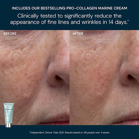 Image 5 - A split image shows a close-up of a persons face from nose to cheek, with the left side labelled BEFORE displaying more pronounced wrinkles and sun spots, and the right side labelled AFTER showing visibly smoother skin with fewer fine lines, with an Elemis Pro-Collagen Marine Cream tube displayed on the left, and overlaying text that states: INCLUDES OUR BESTSELLING PRO-COLLAGEN MARINE CREAM Clinically tested to significantly reduce the appearance of fine lines and wrinkles in 14 days. BEFORE AFTER ELEMIS PRO-COLLAGEN MARINE CREAM Anti-ageing day cream Crème de jour anti-âge ANTI-AGEING 15ml e 0.5 US fl.oz. Independent Clinical Trials 2021. Results based on 38 people over 4 weeks. Image 6 - An image shows two beauty products, a yellow cleansing balm in a clear jar and a light blue eye cream tube, on a dark blue background, featuring the text PRO-COLLAGEN CLEANSING BALM Clinically proven to remove long-wear & waterproof makeup* PRO-COLLAGEN VITALITY EYE CREAM Clinically proven to reduce the appearance of dark circles around the eye area** ELEMIS PRO-COLLAGEN CLEANSING BALM Hydrating cleansing balm ELEMIS PRO-COLLAGEN VITALITY EYE CREAM Replenishing eye cream Crème revitalisante pour les yeux 15 ml e 0.5 US fl.oz. and disclaimers *Independent Clinical Trial 2025. **Independent Clinical Trial 2021. Results based on 35 people over 4 weeks. Image 7 - A five-step Elemis skincare routine is shown with products and their labels: Step 1 First Cleanse, Elemis Pro-Collagen Cleansing Balm Hydrating cleansing balm; Step 2 Second Cleanse, Elemis Pro-Collagen Energising Marine Cleanser Skin energising cleanser Nettoyant énergisant pour la peau 30 ml e 1.0 US fl.oz.; Step 3 Exfoliator, Elemis Dynamic Resurfacing Facial Pads Skin refining pads Disques affinant le grain de peau 14 x 2.1 in (5.5 cm) DIA Pads; Step 4 Eye Cream, Elemis Pro-Collagen Vitality Eye Cream Replenishing eye cream Crème revitalisante pour les yeux; Step 5 Moisturiser, Elemis Pro-Collagen Marine Cream Anti-wrinkle hydrating day cream Crème de jour hydratante anti-rides 15 ml e 0.5 US fl.oz.