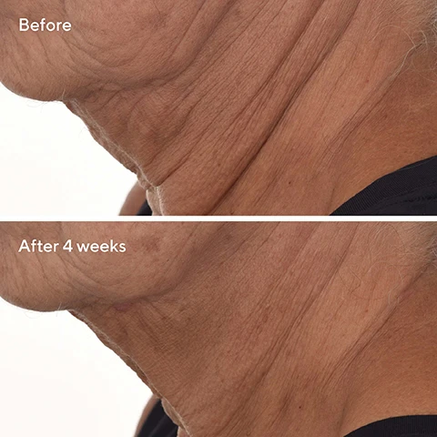 Image 1 - A before and after image shows a persons neck, with the top labeled Before and the bottom labeled After 4 weeks, showing an improvement in skin appearance. Image 2 - A before and after comparison image of a persons forehead showing wrinkles before and smoother skin after 4 weeks, with text Before and After 4 weeks. Image 3 - A before and after image comparison of skin near the mouth showing reduction in fine lines, labeled Before and After 4 weeks. Image 4 - A green bottle of Murad Retinal ReSculpt Overnight Treatment next to large text that says LIFT JAWLINE & NECK AREA IN 2 WEEKS with text on the bottle reading Murad RESURGENCE Retinal ReSculpt Overnight Treatment Retinal ReSculpt Traitement de nuit. Image 5 - A green skincare bottle is partially in water in a glass beaker with text labels Encapsulated Retinal 25x more effective vs free retinal Olive Extract Boosts moisture Kangaroo Paw Flower Extract Sculpts lifts and text on the bottle reading Murad RESURGENCE Retinal ReSculpt Overnight Treatment Retinal ReSculpt Traitement de nuit. Image 6 - A graphic with checkmarks lists points about Murads Encapsulated Retinal Technology under the heading TRUST THE EXPERTS, including Targeted delivery deep within skin, 2.5x more effective vs free retinal for fast results, and Gentle on skin.
