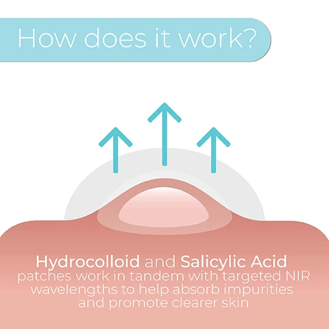 Image 2 - A diagram shows a skin blemish covered by a clear hydrocolloid patch with three arrows pointing upward indicating absorption, with the text How does it work? and Hydrocolloid and Salicylic Acid patches work in tandem with targeted NIR wavelengths to help absorb impurities and promote clearer skin. Image 3 - An infographic displays two treatment methods: a gray patch with blue dots and arrows indicating absorption, labeled Hydrocolloid & Salicylic Acid, and a circular device with blue lights and a patch on top, labeled 2x Expert Recommended Wavelengths, with an accompanying spectrum graph showing peaks for 6x Blue 415nm and 6x NIR 830nm.