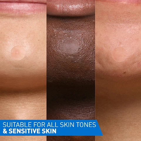 Image 1 - Three close-up images show different skin tones—light, dark, and medium—each with a small, translucent circular patch applied to the skin, with a blue banner across the bottom that reads SUITABLE FOR ALL SKIN TONES & SENSITIVE SKIN. Image 2 - A hand holds a white CeraVe Blemish Control Cleanser pump bottle for Blemish-Prone Skin, with text on the bottle stating Developed with Dermatologists, With 3 essential ceramides, salicylic acid, & niacinamide, OIL-ABSORBING TECHNOLOGY, 8 FL OZ/236 ML, and alongside it are four listed benefits: Cleanses without disrupting the skin barrier, Reduces the appearance of blemishes & blackheads, Unclogs & improves the appearance of pores, Removes excess oil, with a dark teal banner at the bottom repeating For Blemish-Prone Skin. Image 3 - A clear liquid drop with small bubbles on a white background, accompanied by text that reads FORMULA WITH: 2% SALICYLIC ACID, NIACINAMIDE, 3 ESSENTIAL CERAMIDES.