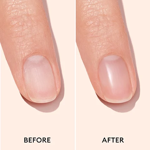 A split image shows a close-up of a finger and nail before and after treatment, with the left side showing a natural nail and the right side showing the nail looking shiny and healthy, labeled BEFORE and AFTER.